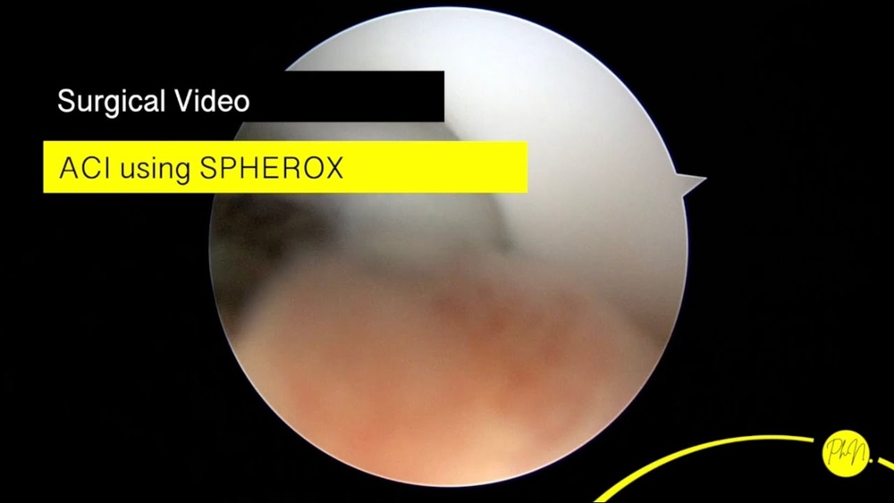 spherox-sospensione-per-impianto-10-70-sferoidi-cm2