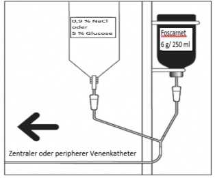 foscarnet-kabi-soluzione-per-infusione-24-mg-ml