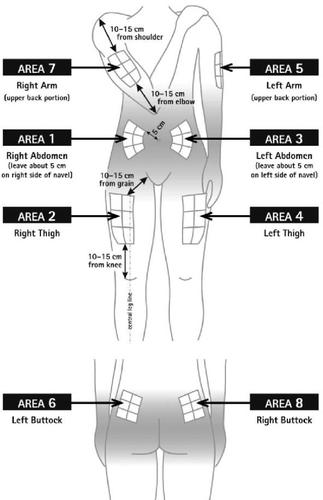 Scheme of the human torso showing numbered injection areas 1 to 8 on arms, abdomen, and thighs with measurements