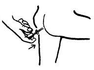 Hand holding a syringe injecting into the skin at a right angle, arrow indicates point of injection