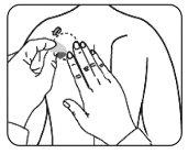Hand applying a subcutaneous injection in the arm with a skin pinch and needle inserted slightly inclined