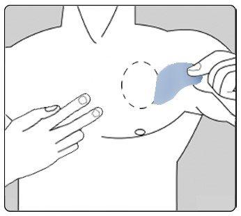 Hand applying a medicinal patch to the upper arm skin, showing the shaded application area and fingers holding the patch