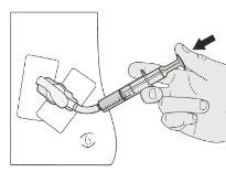 Hand holding syringe with needle inserted into skin, with a safety device connected and an arrow indicating direction