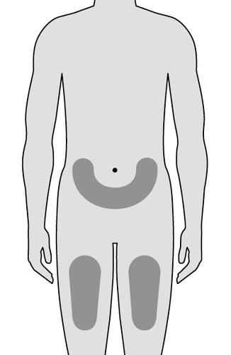 Sketch of a human silhouette with marked injection areas on the abdomen and thighs with a dot indicating the navel