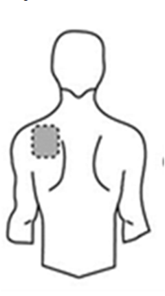 Human silhouette with the area on the upper back marked for patch application