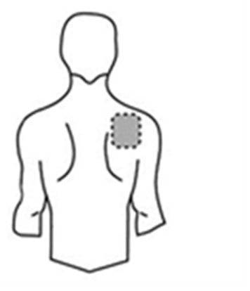 Human silhouette with the area on the back marked for patch application