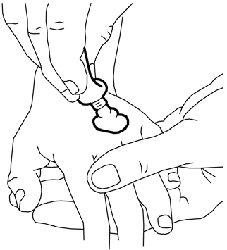 Manos aplicando un apósito sobre un montículo de crema en la piel, se ven los dedos y los contornos de la mano
