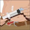 Hand injecting medication with a syringe into abdominal skin, red arrow indicates direction of needle insertion and cotton pad nearby