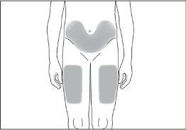 Scheme of the human torso with shaded areas indicating possible injection sites on the hips and upper abdomen
