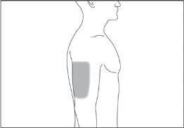Lateral silhouette of the human torso with a shaded area in the upper left gluteal region indicating an injection site