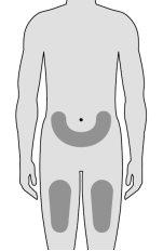 Silueta humana con áreas sombreadas que indican posibles sitios de inyección en abdomen y muslos