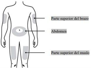 Schematic of human torso with shaded areas indicating abdomen, upper arm, and thigh with arrows pointing to each area