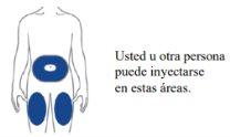 Esquema del torso humano con áreas de inyección marcadas en azul en el abdomen y muslos superiores