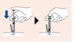 Hand holding syringe with needle inserted into the skin, blue arrow indicates direction of push and plunger advance