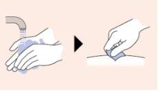 Hands applying a blue gauze to an area of the skin and pressing to stop bleeding after an injection