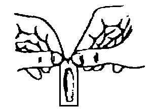Schema di iniezione sottocutanea con ago inserito verticalmente tra due strati di pelle e tessuto adiposo