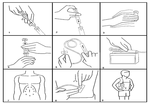 Sequenza di iniezioni sottocutanee e intramuscolari con siringa, preparazione, sito di iniezione e posizionamento del paziente