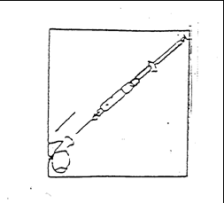 Siringa con ago che penetra nella pelle, indicazione di iniezione sottocutanea con un angolo di circa 45 gradi