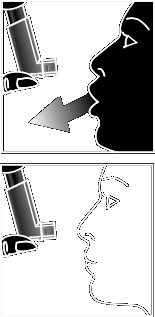 Profilo del viso con inalatore posizionato vicino alla bocca e freccia che indica la direzione dell