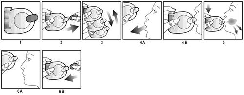 Dispositivo nasale con pistone, frecce che indicano la direzione di inserimento e pressione, profilo del viso e istruzioni numerate da 1 a 6B