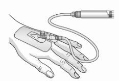 Mano che tiene un dispositivo medico con cavo e connettore, applicato sulla pelle con un elettrodo adesivo grigio