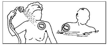 Donna sotto la doccia con due cerotti medicati sul petto e sulla spalla sinistra flusso d