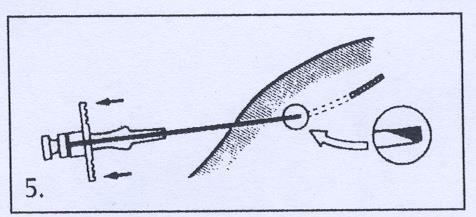 Siringa con ago che penetra nella pelle con un angolo indicato da una curva e frecce, dettaglio ingrandito della punta
