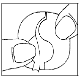 Schema lineare che mostra una sezione trasversale di un vaso sanguigno con un coagulo di sangue all