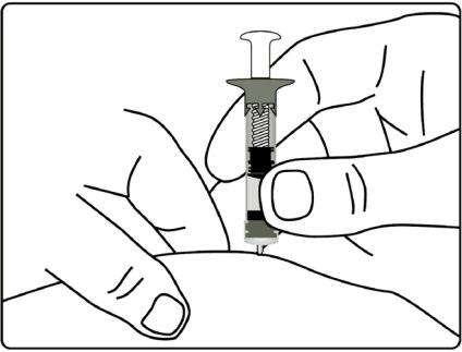 Mano che tiene una siringa preriempita con ago inserito nella pelle, pistone parzialmente premuto e corpo cilindrico trasparente