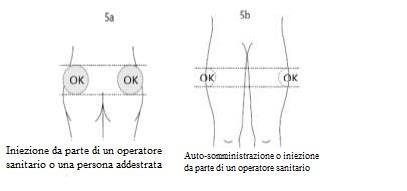 Schema di due corpi con indicazioni di iniezione sottocutanea contrassegnate da