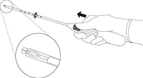 Mano che impugna un dispositivo medico allungato con punta affilata e meccanismo di blocco evidenziato da un ingrandimento