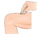 Mano che tiene una siringa con ago inserito nella pelle del braccio, tecnica di iniezione sottocutanea mostrata su pelle chiara