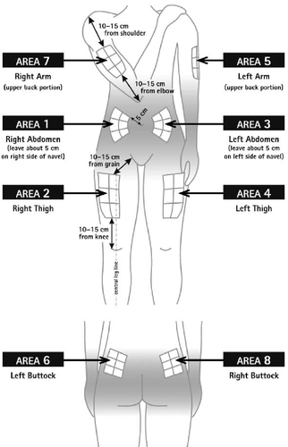 Schema del corpo umano con indicate le aree di iniezione: braccia, addome, cosce e glutei con distanze in centimetri da riferimento