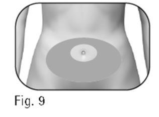 Torso umano con evidenziata area ombelicale grigia e cerchio interno più chiaro per indicare il sito di iniezione