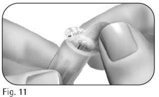 Dita che afferrano una cartuccia trasparente con un ago metallico inserito nell