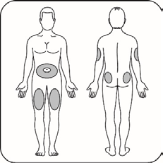 Schema del corpo umano frontale e dorsale con aree grigie che indicano possibili siti di iniezione addominale, cosce e glutei