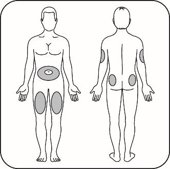 Schema del corpo umano con aree ombreggiate che indicano possibili siti di iniezione sottocutanea addome fianchi cosce
