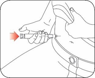 Mano che tiene una siringa prera mpita con ago inserito nella cute, freccia rossa indica la direzione dell