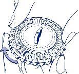 Dispositivo medico con anello esterno scanalato e parte interna bianca a forma di cupola con un