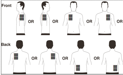 Schizzi di figure umane con indicazioni di iniezione sottocutanea nella parte superiore della schiena e del torace, con