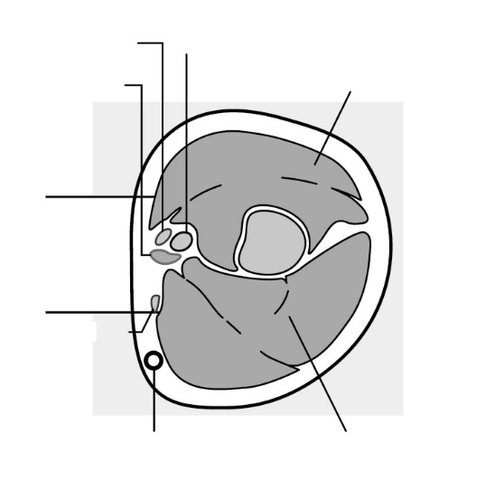Sezione trasversale del cuore umano che mostra le quattro camere, le valvole e i principali vasi sanguigni