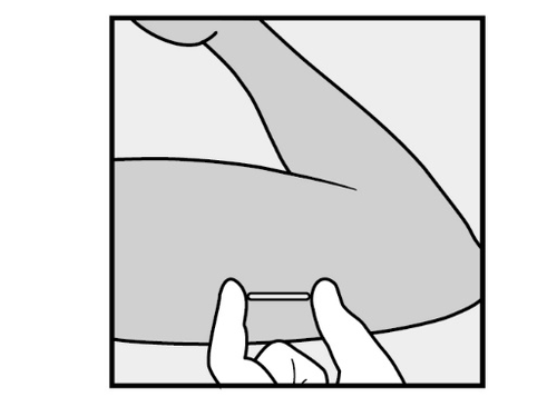 Mano che afferra una penna iniettabile con ago esposto sopra una superficie cutanea stilizzata