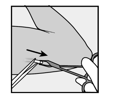 Mano che afferra una pinzetta con un piccolo oggetto tra le punte e una freccia nera indica il punto di presa