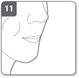 Profilo stilizzato di un volto umano con linea che indica la zona di iniezione nella guancia e labbro superiore