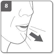 Profilo di un volto con freccia nera che indica la zona di iniezione nella guancia interna vicino alla bocca