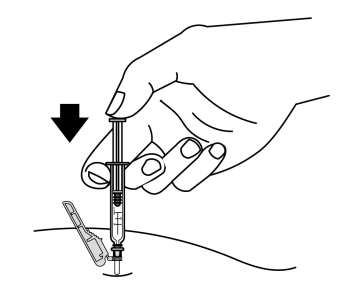 Mano che tiene una siringa con ago inserito nella pelle, freccia nera indica la direzione dell