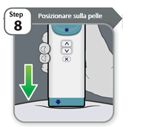 Dispositivo medico bianco con pulsanti e frecce direzionali posizionato sulla pelle grigia con freccia verde che indica verso il basso