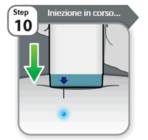 Iniezione sottocutanea in corso con ago inserito nella pelle e frecce verdi e blu che indicano la direzione