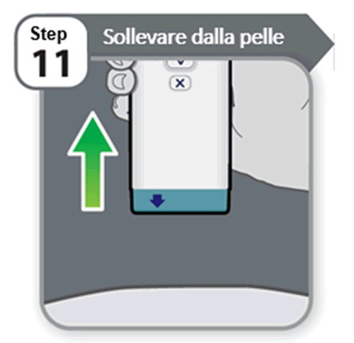 Dispositivo medico con freccia verde verso l