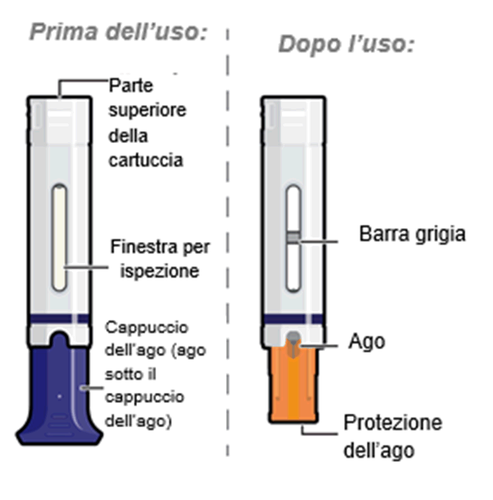 Cartuccia per iniezione con indicazioni di parte superiore, finestra di ispezione, cappuccio dell